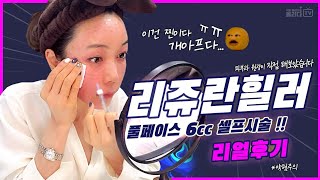 (*Eng/JPN) [AllidaTV] 풀페이스 #리쥬란 6cc 시술, 피부과 원장이 직접 해봤습니다!!