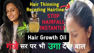 कैसे भी पतले झड़ते कमजोर बाल हो, Receding Hairline,गंजापन हो- इस Remedy से उगेंगे दुगनी तेज़ी से बाल