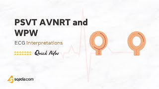 ECG Interpretations | PSVT AVNRT and WPW | STEMI and NSTEMI | Cardiology