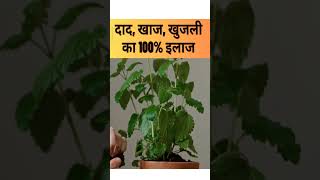 दाद खाज खुजली का 100% इलाज 😱 | dad khaj khujli ki dawa #shorts #facts #skinproblems #viralvideo