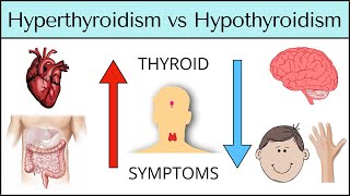 Hyperthyroidism vs Hypothyroidism: Symptoms MADE EASY [Thyroid Explained]