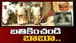 Fluoride problem accentuates renal diseases in Prakasam || Sakshi Special - Watch Exclusive