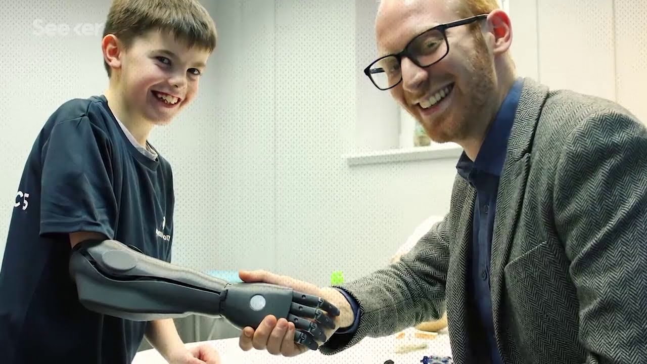 Bionic Limbs: Technology To Help The Amputees - YouTube