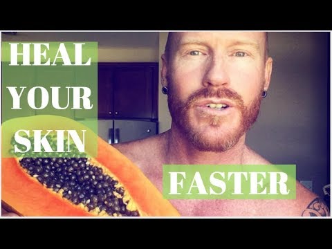 How To Speed Up The Healing Process (Eczema , Dermatitis) How To Speed Up The Healing Process (Eczema , Dermatitis)