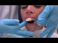 taking an awesome alginate impression