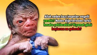 Allah Neden Bazı İnsanları Engelli Yarattı? Neden Diğerlerinden Farklı Hesaba Çekilecekler?