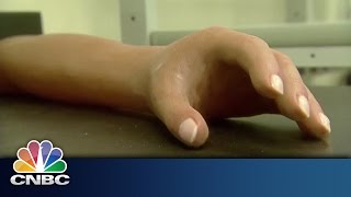 Bionic Arms | Innovation Cities | CNBC International