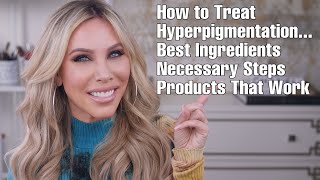 Treating Hyperpigmentation, Sun Damage, Melasma | WHAT YOU NEED TO DO!