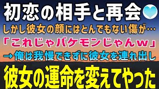 【感動する話】同窓会で初恋の相手と再会。しかし彼女の顔には大きな傷があり…「バケモノじゃんw」→心ない声に俺は我慢できなくなり彼女を連れ出した。彼女の事情を聞くと…【泣ける話】朗読