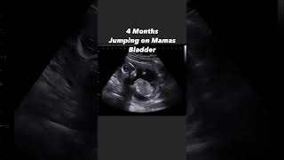 Already jumping on moms bladder at 16 weeks 😂 #jerbearimaging #inhomeultrasound #baby #bouncy