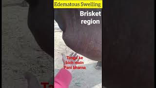 edematous swelling l Dr Umar Khan