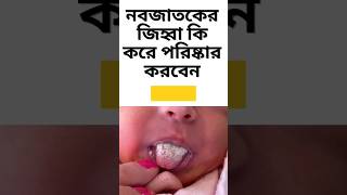 নবজাতকের জিহ্বা কি করে পরিষ্কার করবেন l #shortvideo #shorts #viral