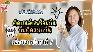 ติดเหล็กจัดฟัน | ติดบน-ล่างพร้อมกัน หรือ แยกกันติด แบบไหนดีกว่ากัน?| หมอตาล ทันตกรรมฟ้าใส ระยอง