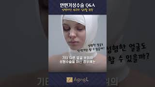 필러/보톡스/다른 성형한 사람은 😖 안면거상수술 못하나요?