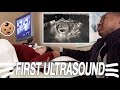 FIRST PREGNANCY ULTRASOUND | 7 WEEKS PREGNANT