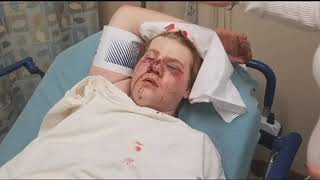 Murray County man looking for justice in alleged assault