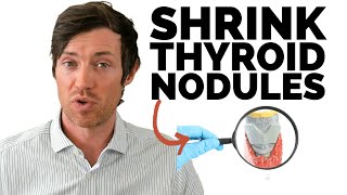 Shrink Thyroid Nodules With These 6 Treatments