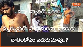 SAAKSHYAM TV | NELLORE |నరాలవ్యాధితో నరకం...మృత్యువుతో పోరాడుతున్న దళితుడు...దాతలకోసం ఎదురుచూపు...?