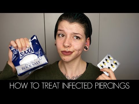 Infected Piercings: Everything You Need to Know Infected Piercings: Everything You Need to Know