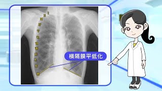 Dr 長尾の胸部X線クイズ初級編 第1回「場所が言えなきゃ始まらない」【期間限定配信】 - 臨床医学チャンネルCareNeTV