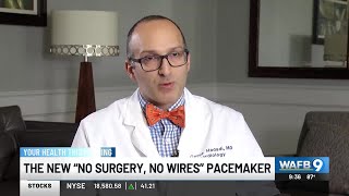 YOUR HEALTH: New ‘no surgery, no wires’ pacemaker
