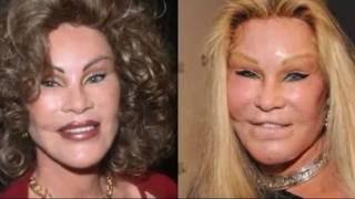 Worst Plastic Surgery Before And After Hollywood