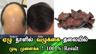 ஏழு நாளில் வழுக்கை தலையில் முடி முளைக்க | Bald To Hair | | valukkai thalai mudi valara Tips in Tamil