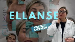 ✨ Full Face Transformation with Ellansé ✨