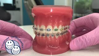 Elastics in Orthodontics - Class 3