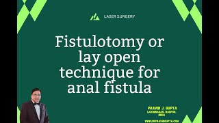 LAYING OPEN THE ANAL FISTULA TRACT- QUICK AND EFFECTIVE