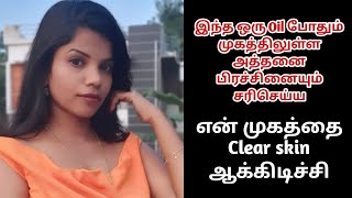 இந்த Oil என் முகத்தை Clear skin ஆக்கிடுச்சி|Suji|Sujislifestyle