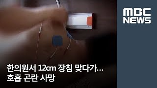 한의원서 12cm 장침 맞다가…호흡 곤란 사망 / MBC