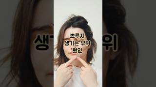 얼굴에 뾰루지가 생기는 부위별 원인