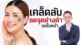 เคล็ดลับลดจุดด่างดำบนใบหน้า |#หมอทีม