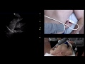 Introduction to Ultrasound Physical using PEARLS