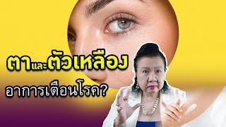 ตาและตัวเหลือง อาการเตือนโรคที่คนอีกเยอะไม่รู้ | พี่ปลา healthy fish