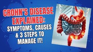 Crohn's Disease Explained: Symptoms, Causes \u0026 3 Steps to Manage It!