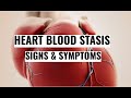 Early/Late Stage Signs & Symptoms of Heart Blood Stasis (Chinese Medicine)