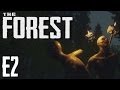 THE FOREST! Now with less down there bits!! E2 ( Alpha Gameplay )