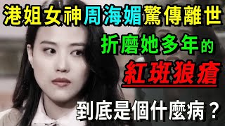 港姐女神周海媚驚傳離世，長期困擾她的紅斑狼瘡，到底是個什麼病？一次性帶你認識人人談之色變的「不死癌症」【養生常談】