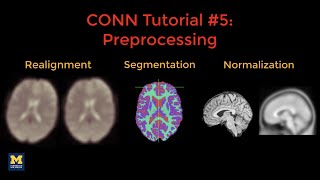 CONN Tutorial #5: Preprocessing