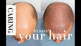 How To Take Care of My Bald Head For Free (Almost)