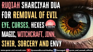 Ruqiah Dua For Removal Of Evil Eye, Curses, Hexes, Magic, Witchcraft, Jinn, Sihir, Sorcery And Envy.