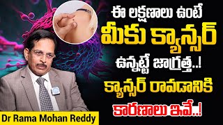 ఈ లక్షణాలు ఉంటే మీకు క్యాన్సర్ ఉన్నట్టే జాగ్రత్త..! | What Causes Cancer ? | Dr Rama Mohan Reddy