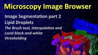 MIB: Image Segmentation tutorial 2: brush, shape interpolation, local thresholding