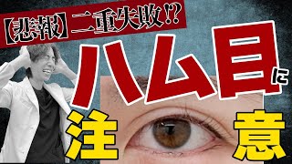 【二重経験者必見】ハム目について正しい知識をつけてください。