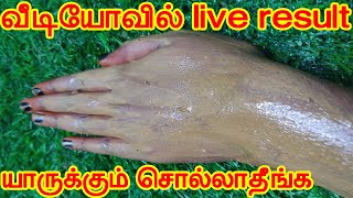 மறக்காம பாருங்க நீங்களும் வெள்ளையாகலாம் | skin whitening home remedies tamil | beauty tips in tamil