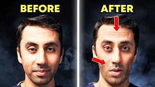 The Truth Behind Ozempic Face (Wegovy) | Doctor Explains