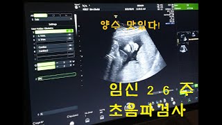 【출산 Vlog#4】 임신 26주 임당검사,초음파검사