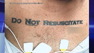 How Hospital Reacted to Man’s 'Do Not Resuscitate' Tattoo